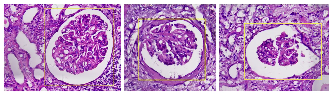 Three examples of glomeruli identified and segmented by NephroPath’s kidney AI algorithms during Pramana’s scanning process.