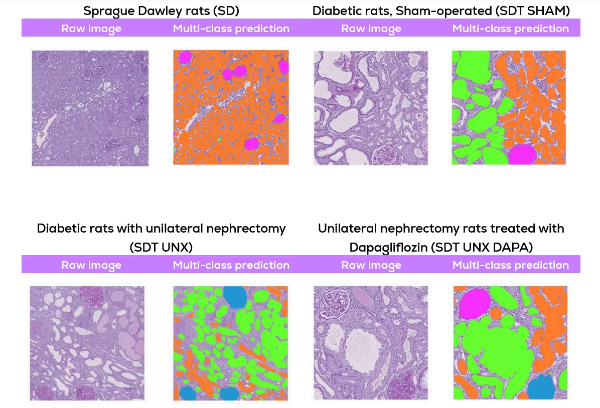 Representative raw PAS staining and NephroPath AI multi-class prediction images of four experimental groups in an experiment to assess the effectiveness of Dapagliflozin in diabetic animal models: Sprague Dawley rats (SD), Diabetic rats, Sham-operated (SDT SHAM), Diabetic rats with unilateral nephrectomy (SDT UNX), Unilateral nephrectomy rats treated with Dapagliflozin (SDT UNX DAPA). Legend: Glomeruli (pink), tubuli (orange), atrophic tubuli (green), sclerotic glomeruli (blue).