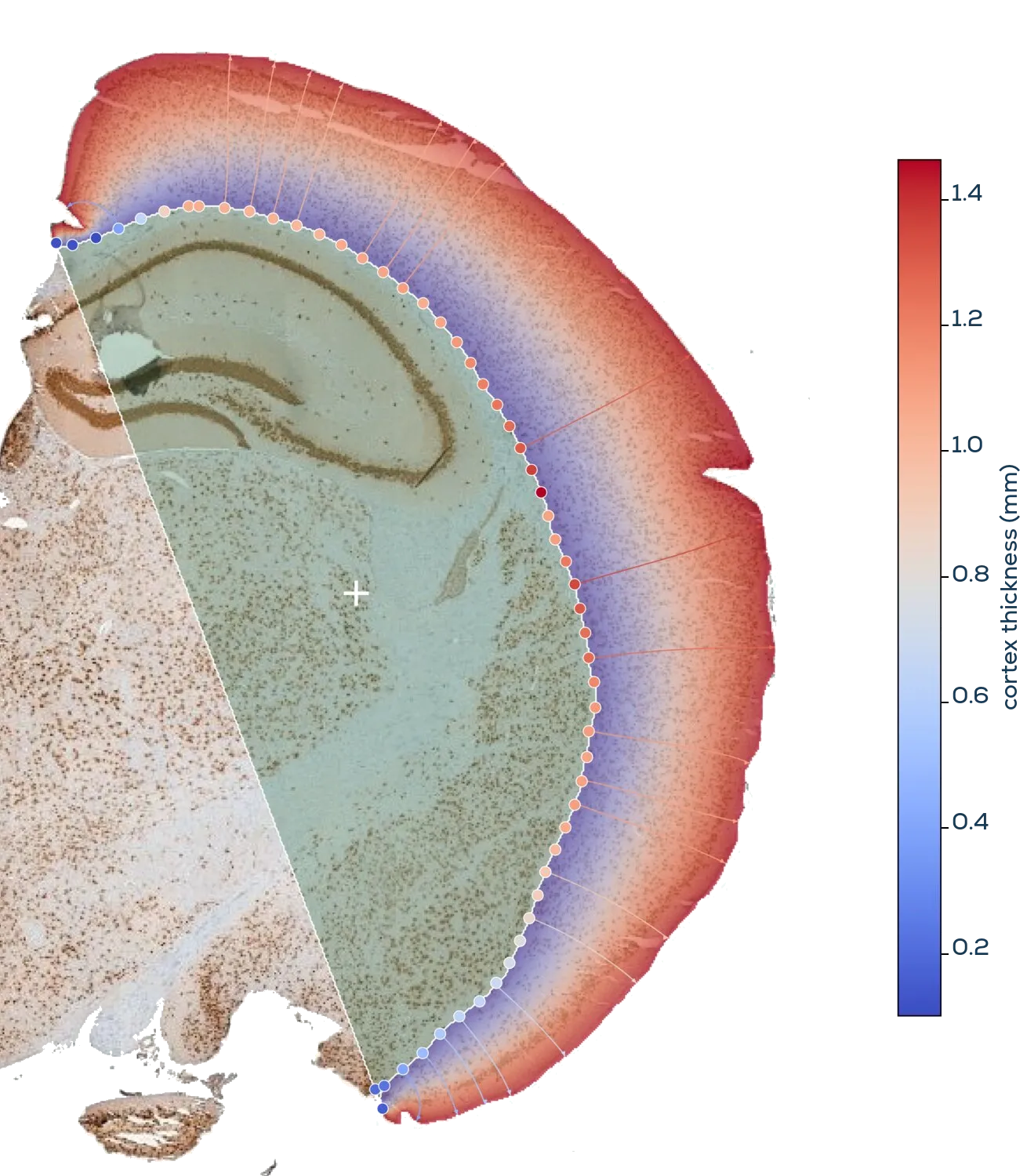 A brain section with cortical thickness measured along the cortical ribbon and rendered as a color map. Each point on the inner cortical boundary represents a measurement point, with color encoding thickness from thin (blue) to thick (red).