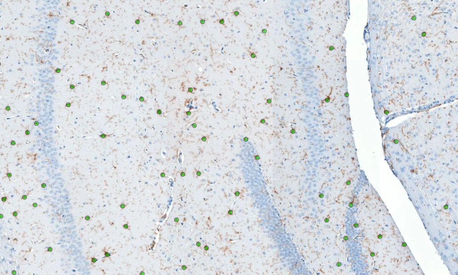 An Iba1-stained field with each microglial cell the AI detected marked individually.