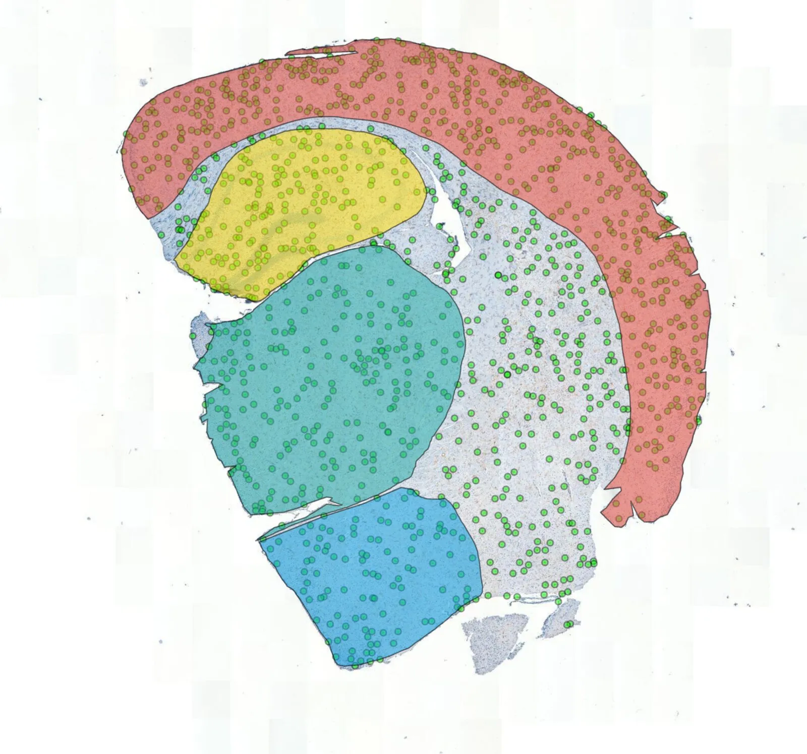 A whole brain section with detected Iba1-positive microglia marked across the tissue, inside the delineated regions.