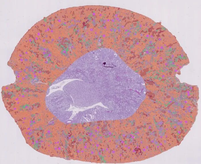 Case Study: Leveraging AI for quantitative assessments of kidney health in diabetic animal models