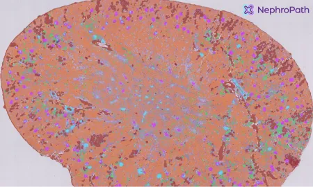 Aiosyn launches Kidney Image Analysis Services through its NephroPath platform to accelerate drug development studies