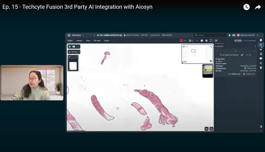 Webinar. From Pixels to Pathology Insights: Integrating Aiosyn's AI into the Techcyte Fusion Platform