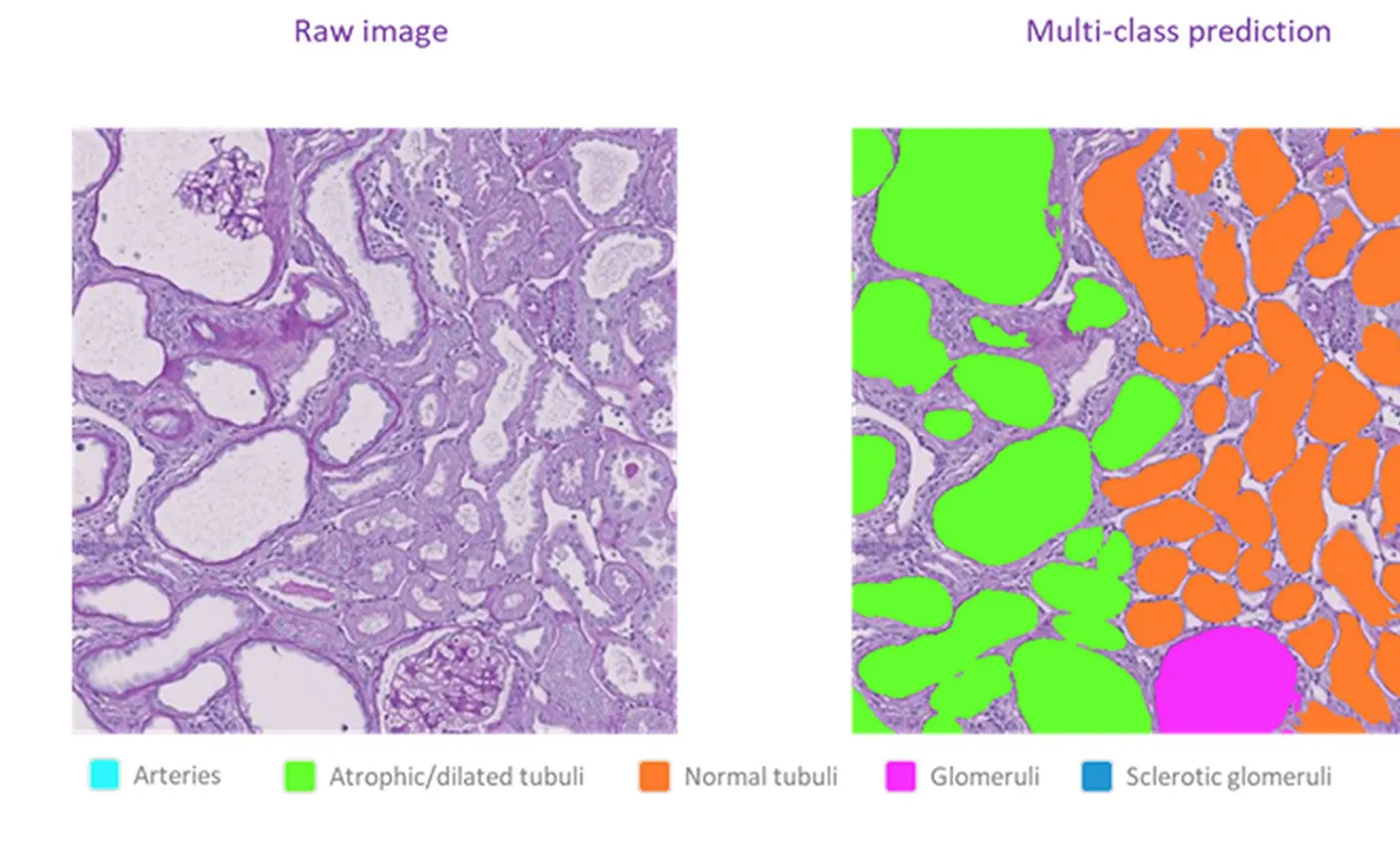 Representative PAS-stained rat kidney tissue beside the NephroPath AI multi-class prediction, with arteries, normal tubuli, atrophic and dilated tubuli, glomeruli and sclerotic glomeruli labelled by colour.