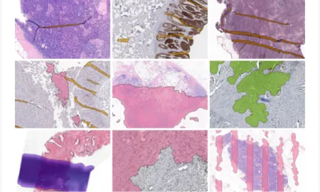 How automated quality control of whole slide images can increase the efficiency of clinical and research pathology workflows