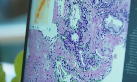 Aiosyn and Radboudumc are the first in the Netherlands to implement AI in the clinical pathology workflow