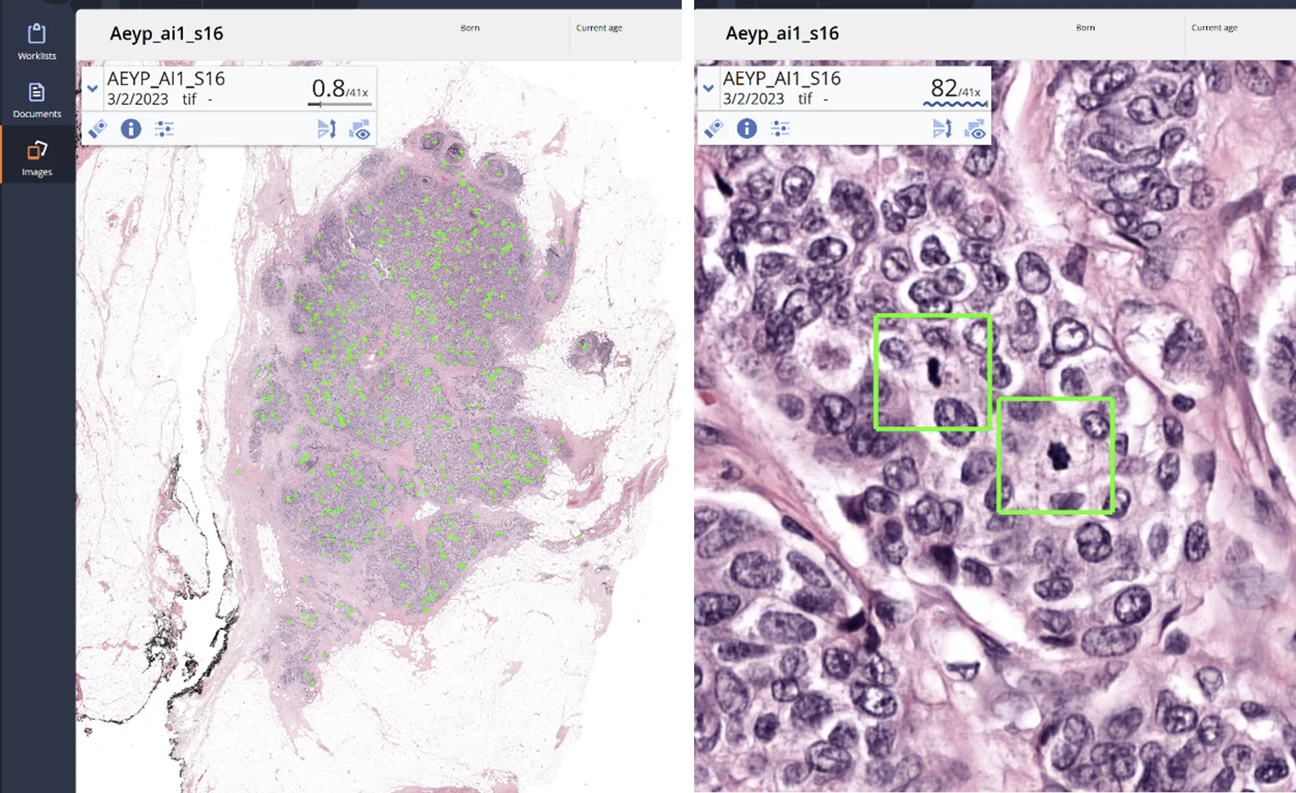 Aiosyn Mitosis Breast becomes the first AI-powered mitosis detection solution to achieve CE mark certification under IVDR