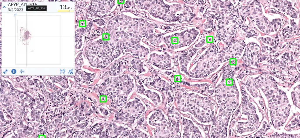 Techcyte, Pramana, and Aiosyn collaborate to advance digital pathology workflow with Edge AI Technology