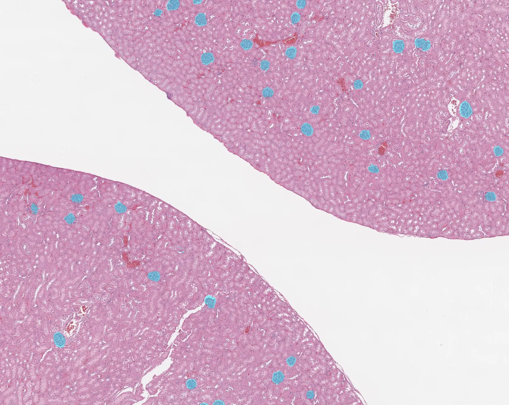 Aiosyn's kidney image analysis tools are now available on HistoWiz's PathologyMap™