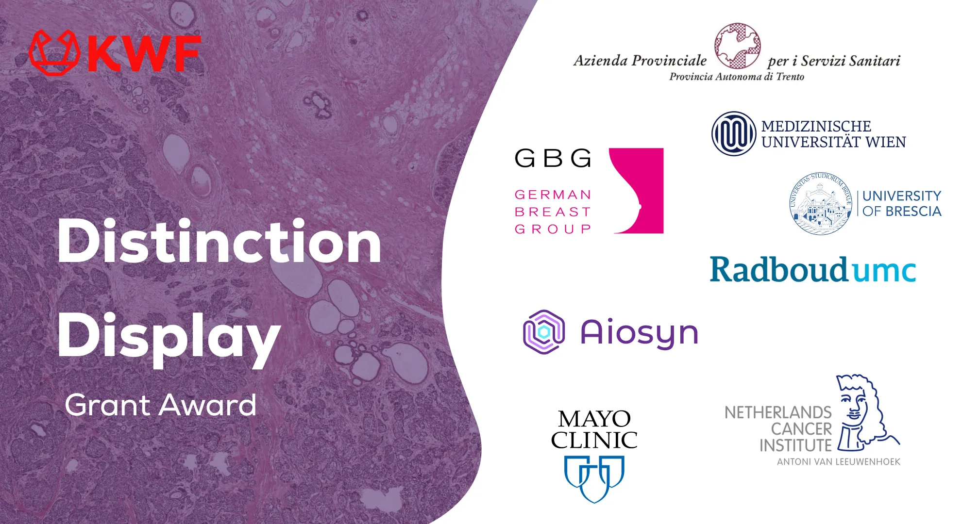 Aiosyn, Radboudumc, NKI, Mayo Clinic, and partners have been awarded 1.8M KWF grant to deliver AI-based assessment of existing and new histopathological biomarkers in breast cancer