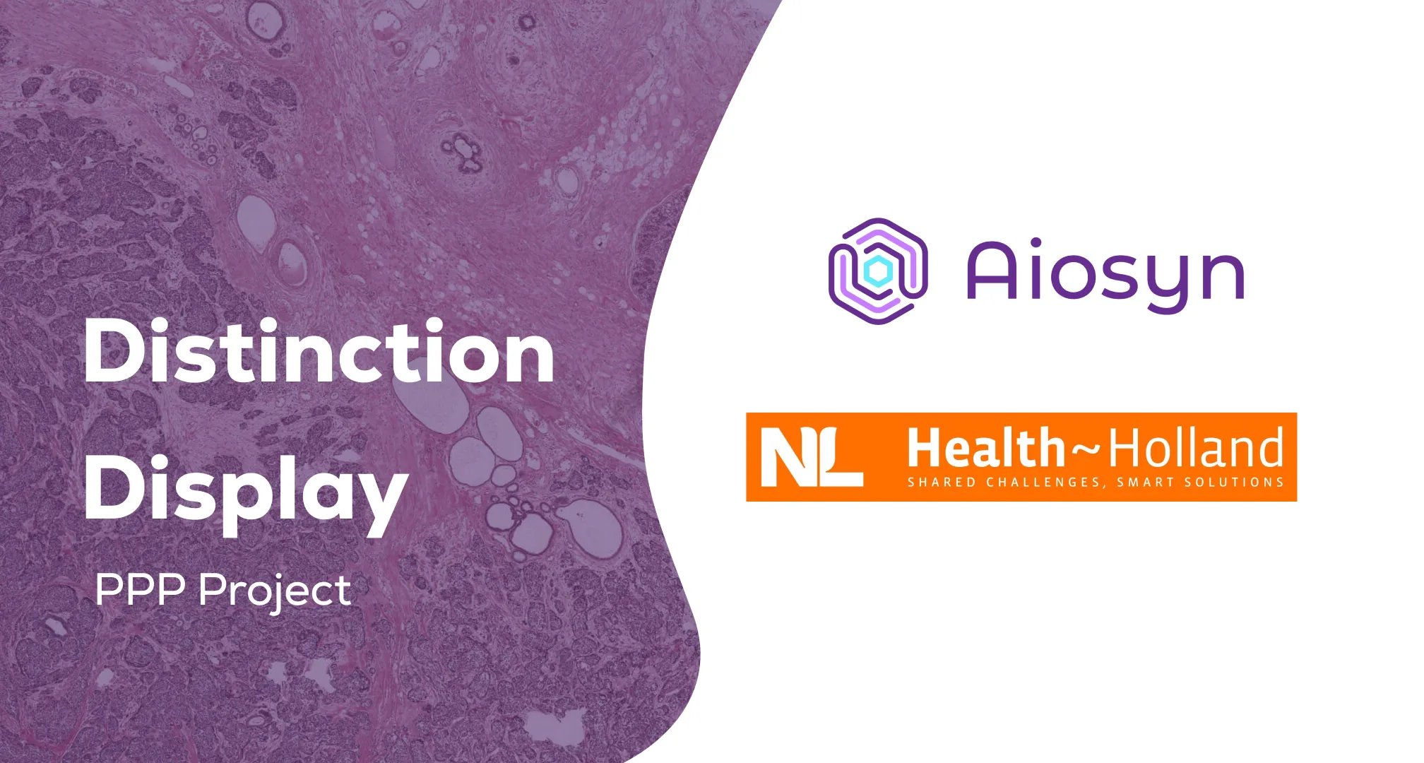 Aiosyn receives a PPP project to improve breast and prostate cancer grading