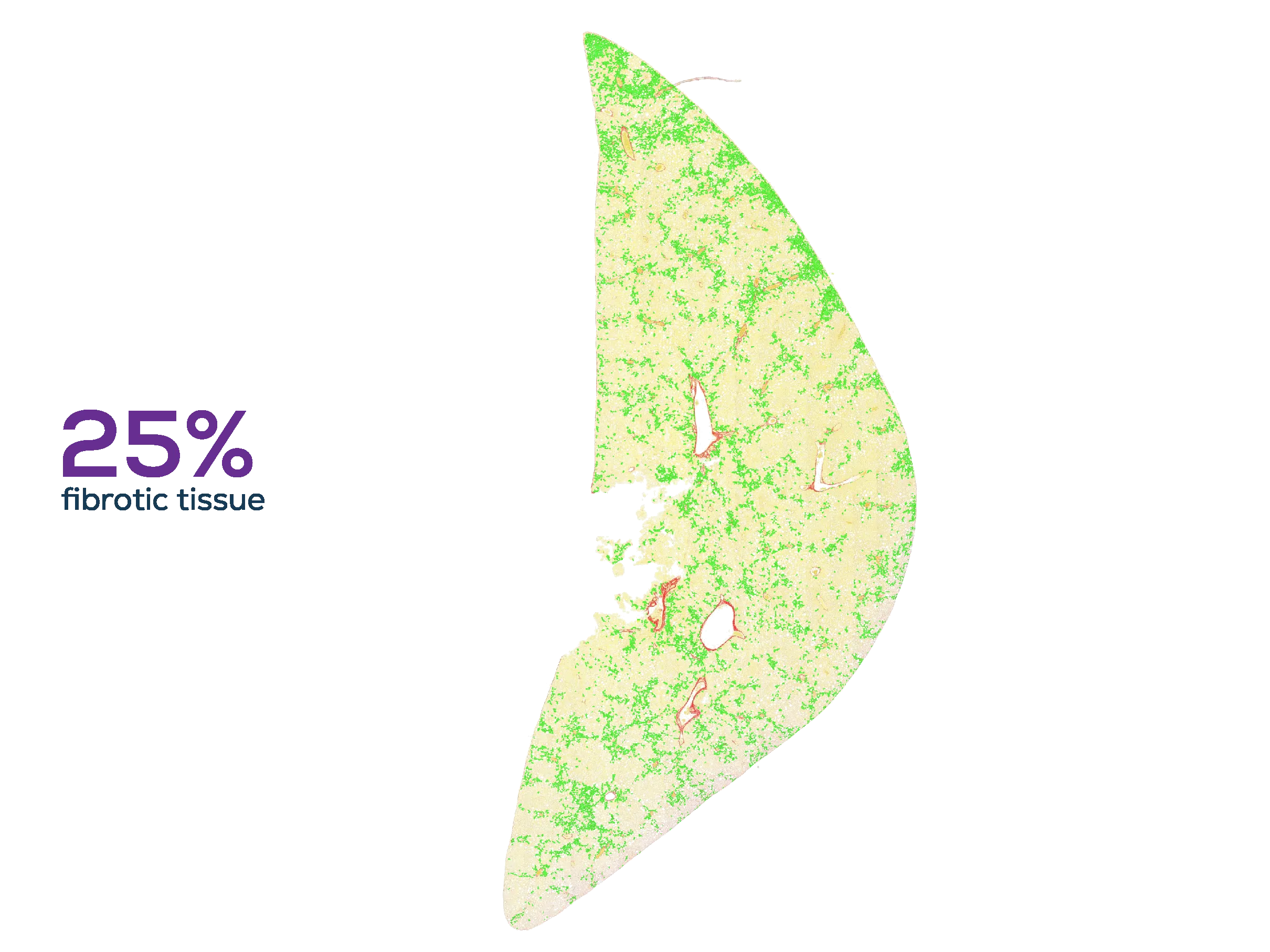 A whole mouse liver section with fibrosis segmented across the tissue by the Aiosyn AI, shown in green.