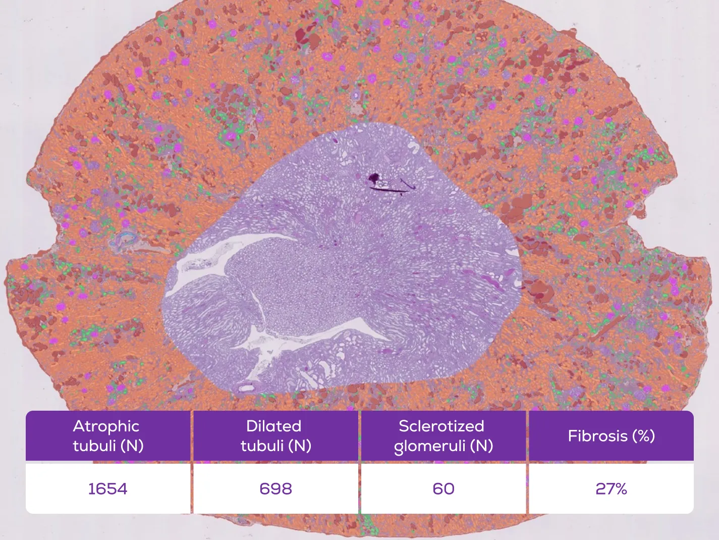 Aiosyn's AI analysis of a whole kidney section, with every structure classified across the tissue.