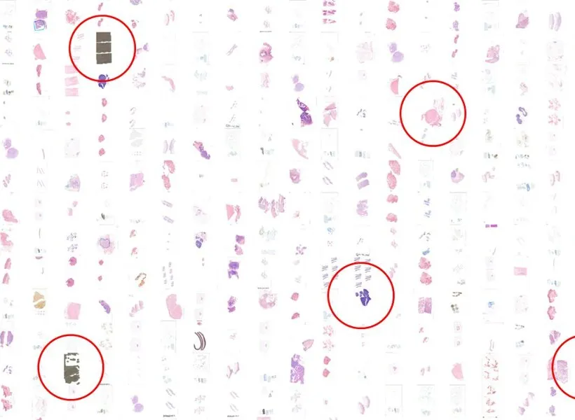 A batch of whole-slide images shown as thumbnails at low magnification, with the images AiosynQC flagged circled: a pen marker, a fold and heavily stained sections among several hundred clean ones.