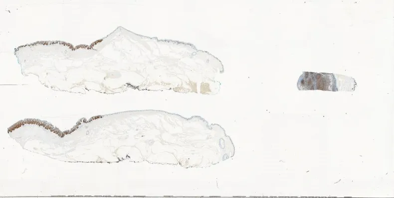 Macro image of a glass slide holding two tissue sections and a control fragment.