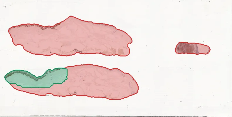 The AiosynQC read-out on the macro image, marking missing tissue in red and the captured region in green.