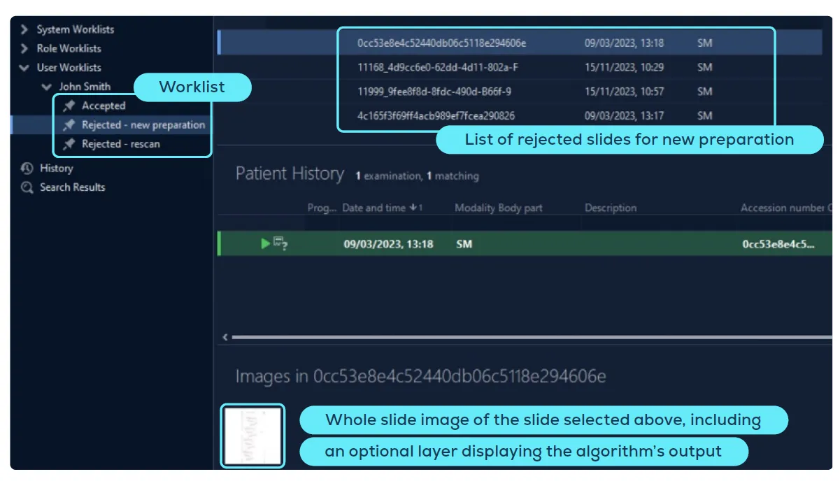 AiosynQC worklists in a pathology platform: user worklists for accepted slides, slides rejected for a new preparation and slides rejected for a rescan, with the whole-slide image of the selected slide previewed underneath.