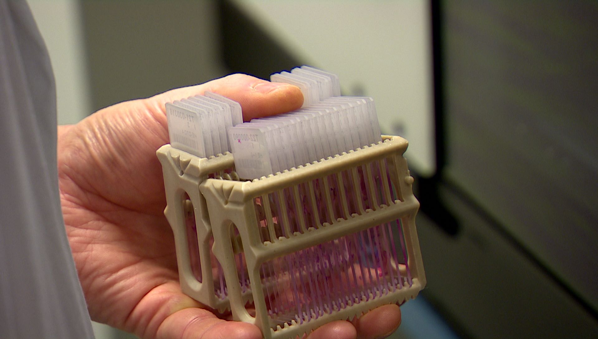 Close-up on a lab technician's hand carrying a rack with multiple histology glass slides.