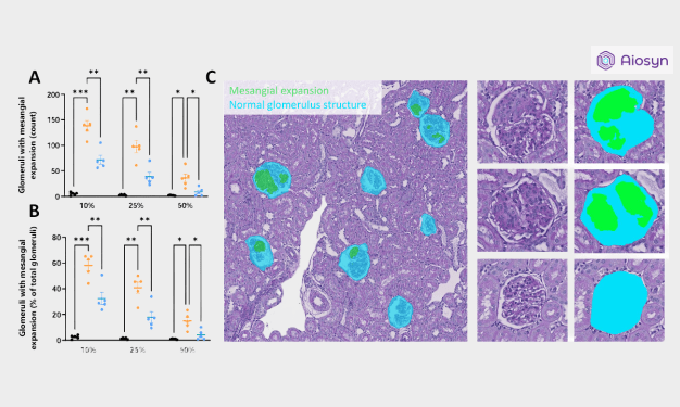 Bar charts and image examples of the assessment of glomeruli expansion in rat models, showing the quantitative image analysis results through NephroPath's computational pathology tools. This figure is part of Physiogenex's poster 