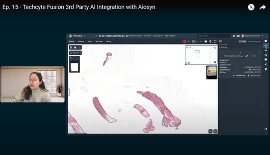 Webinar. From Pixels to Pathology Insights: Integrating Aiosyn’s AI into the Techcyte Fusion Platform