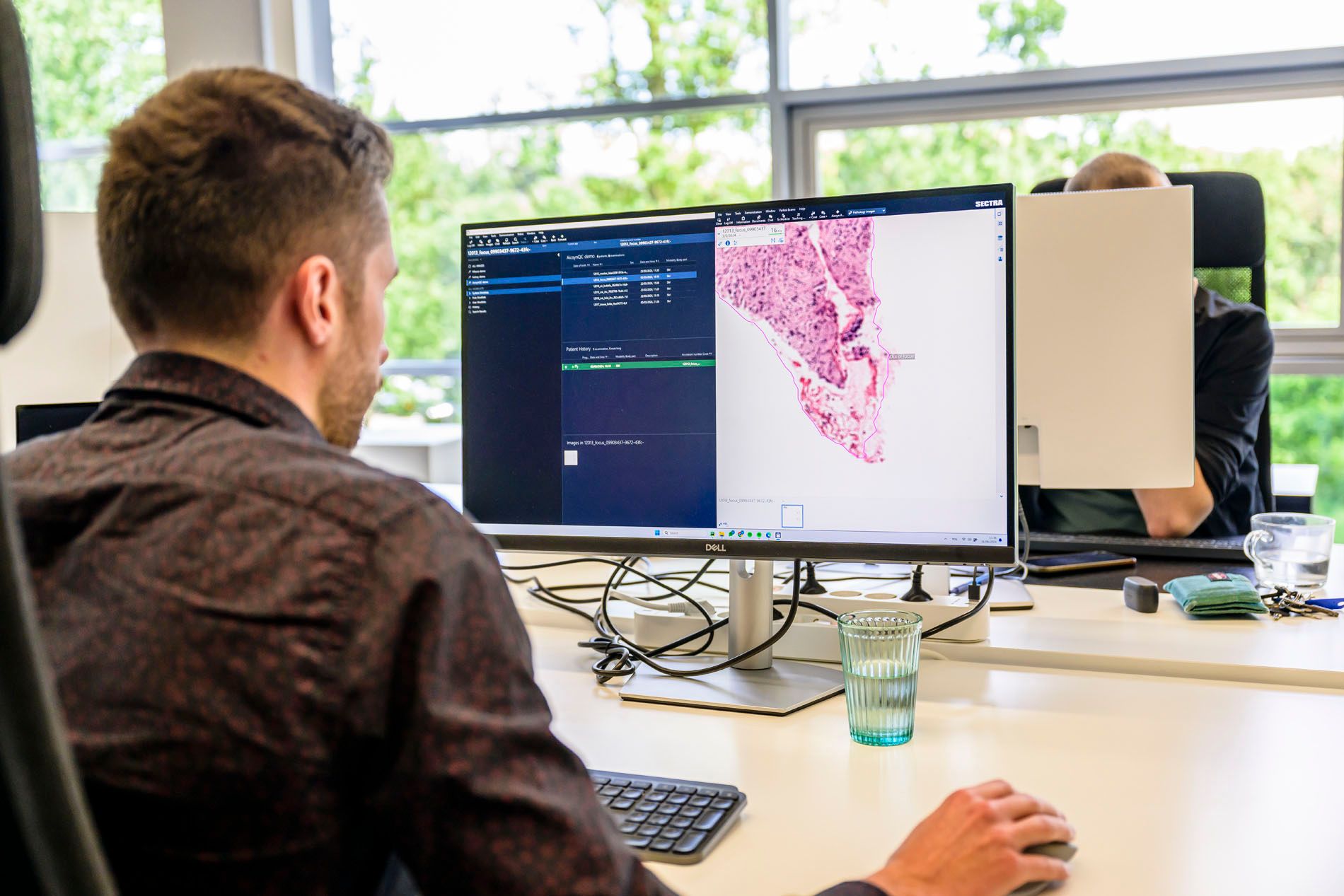 AiosynQC Webinar: Enhancing digital pathology workflows with AI-powered quality control