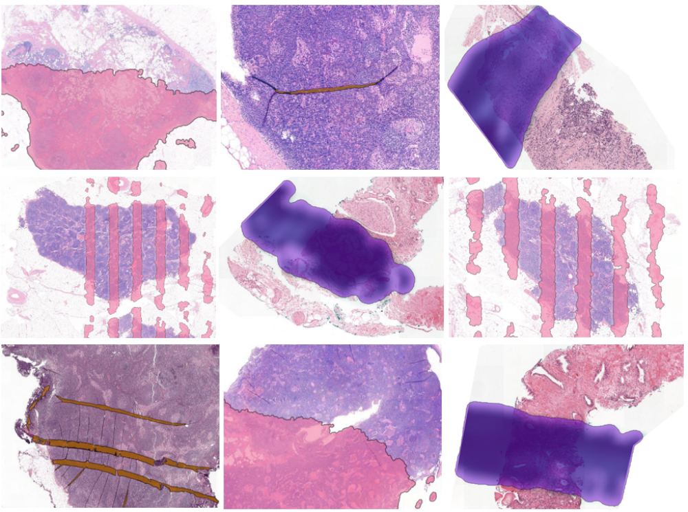 Automated Quality Control - Aiosyn